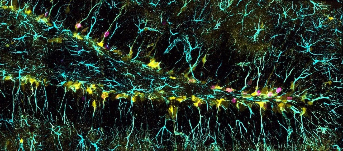 dentate gyrus, microscopy image, Immunostaining with EdU, GFAP and YFP
