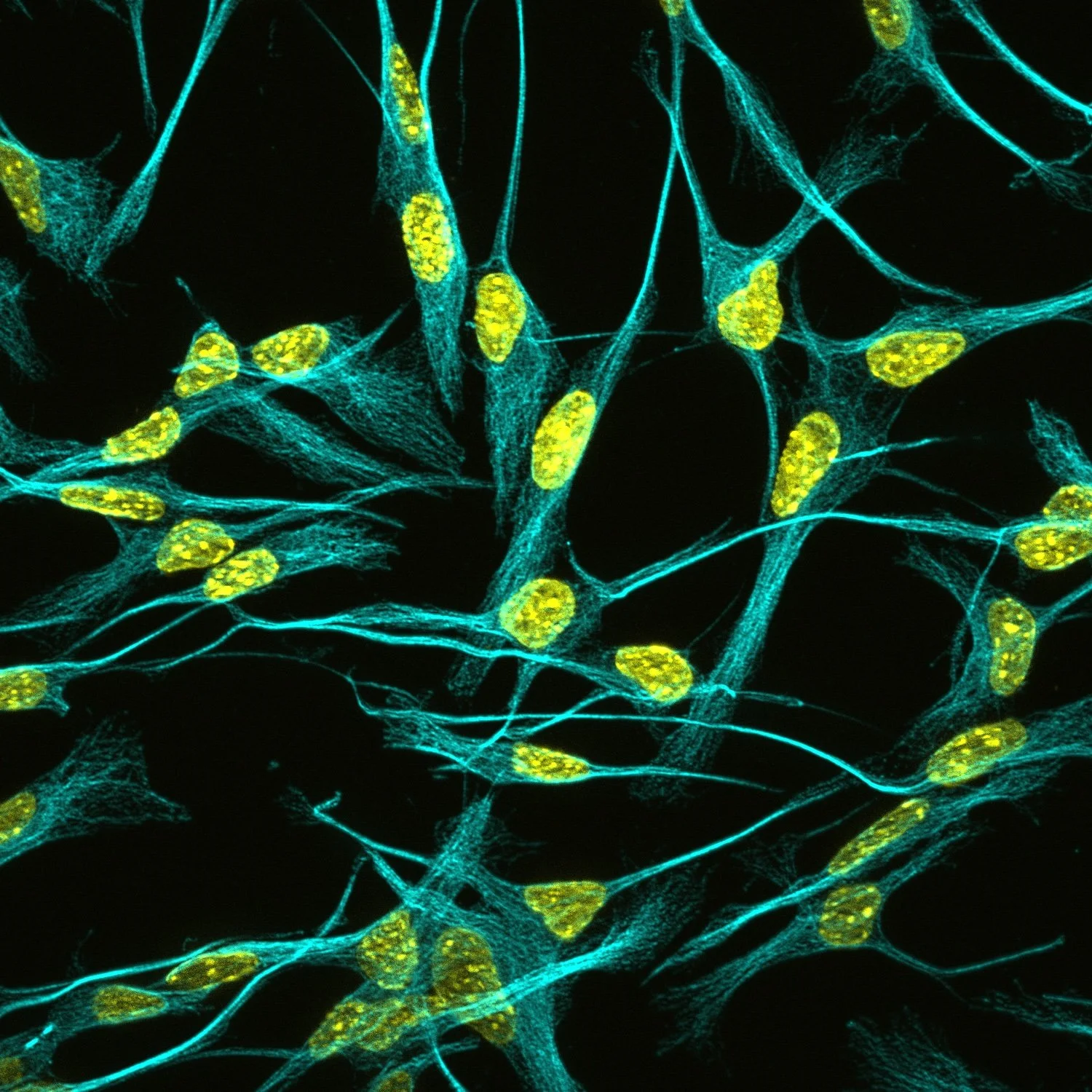active-alpha-tubulin-dapi (©G. Pushpa Bose)