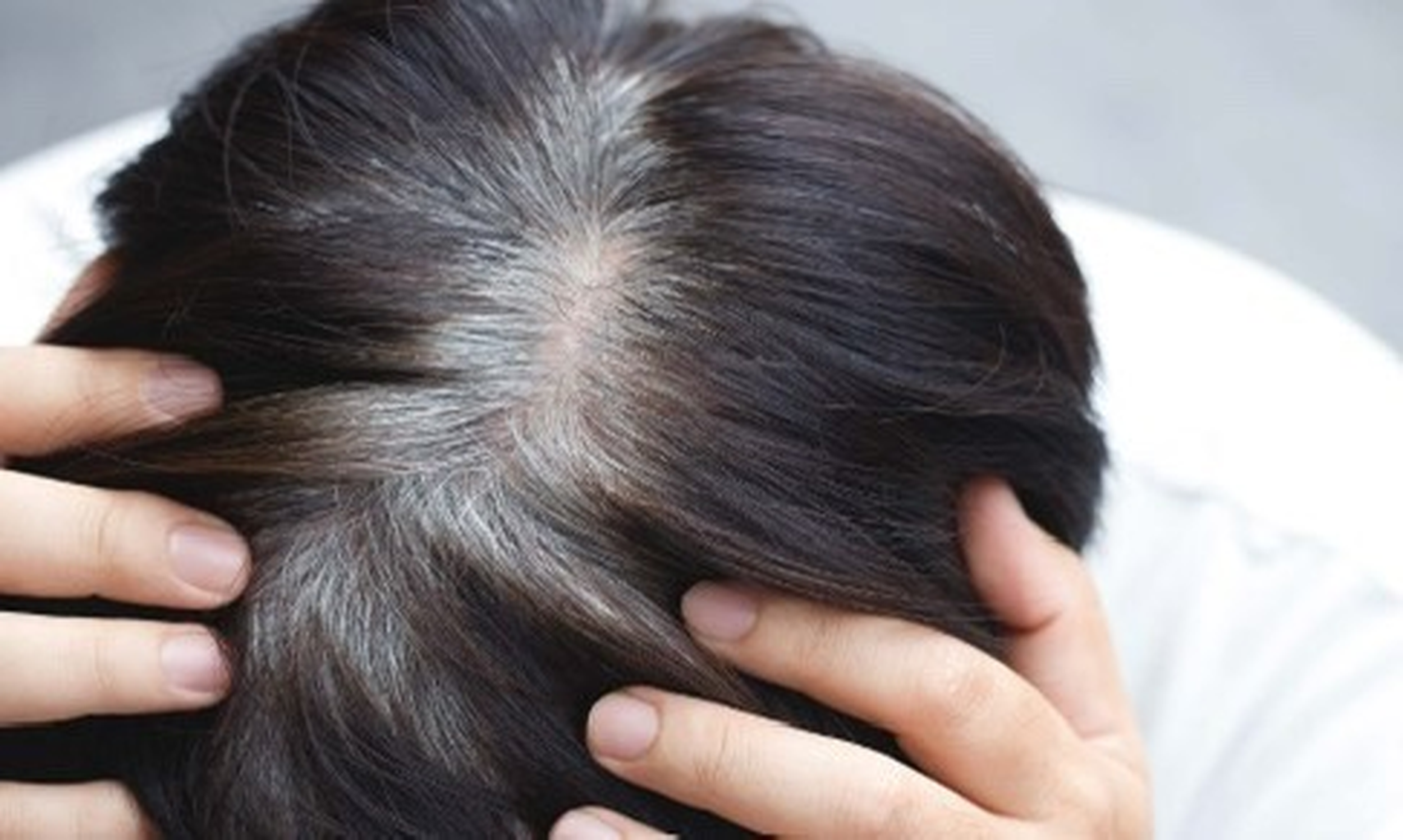 Palitya — The Silver Strands: Understanding Hair Greying Through Ayurveda &amp; Modern Science