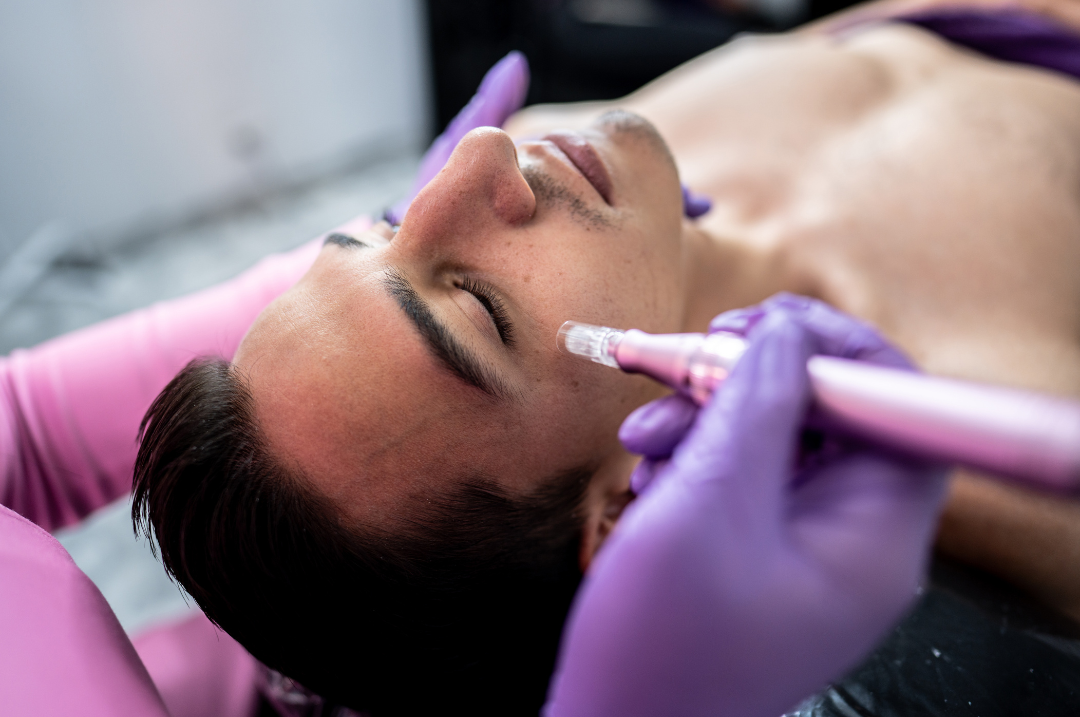 Medspa in Festus, MO, 63028 Microneedling Near Me