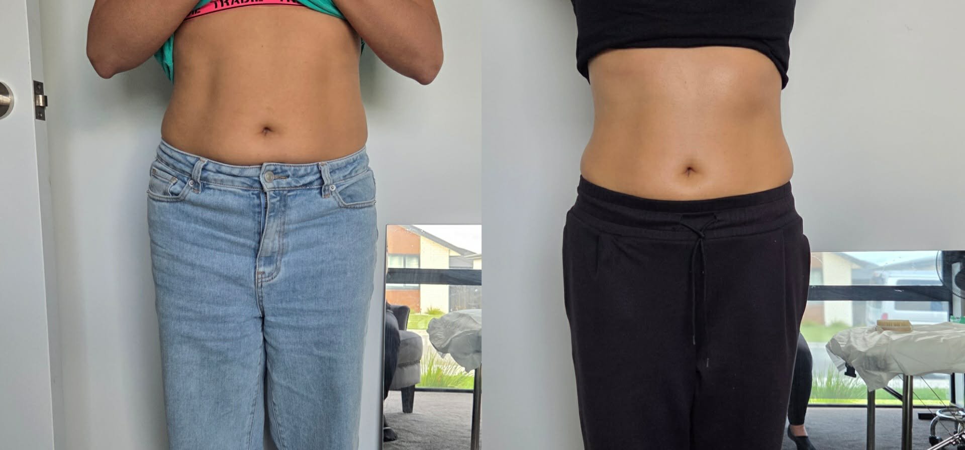 See real fat cavitation client progress and body sculpting results at SheContour Body & Skin in Woodend near Christchurch. Non-surgical inch loss treatments.