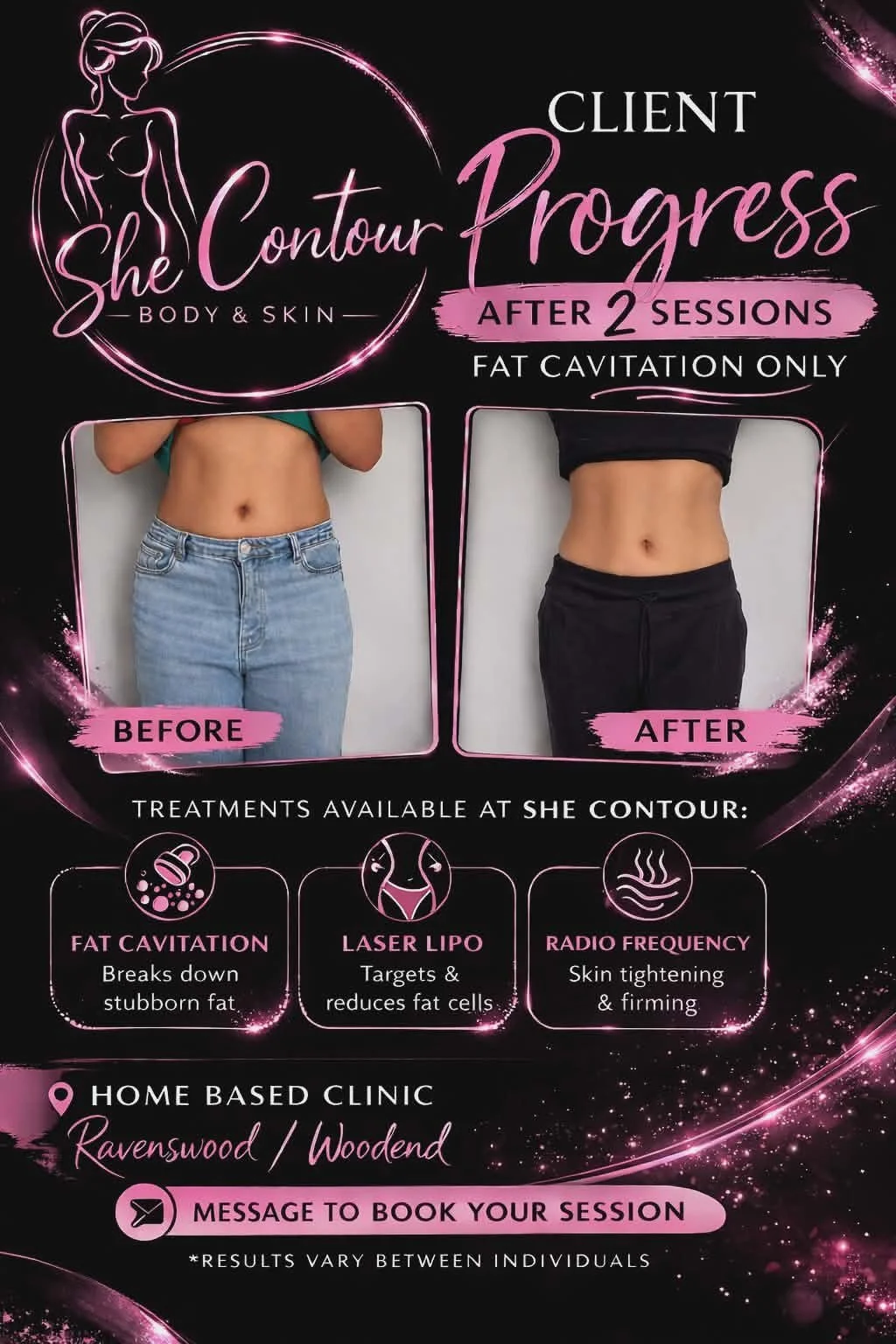 Fat Cavitation Sculpting