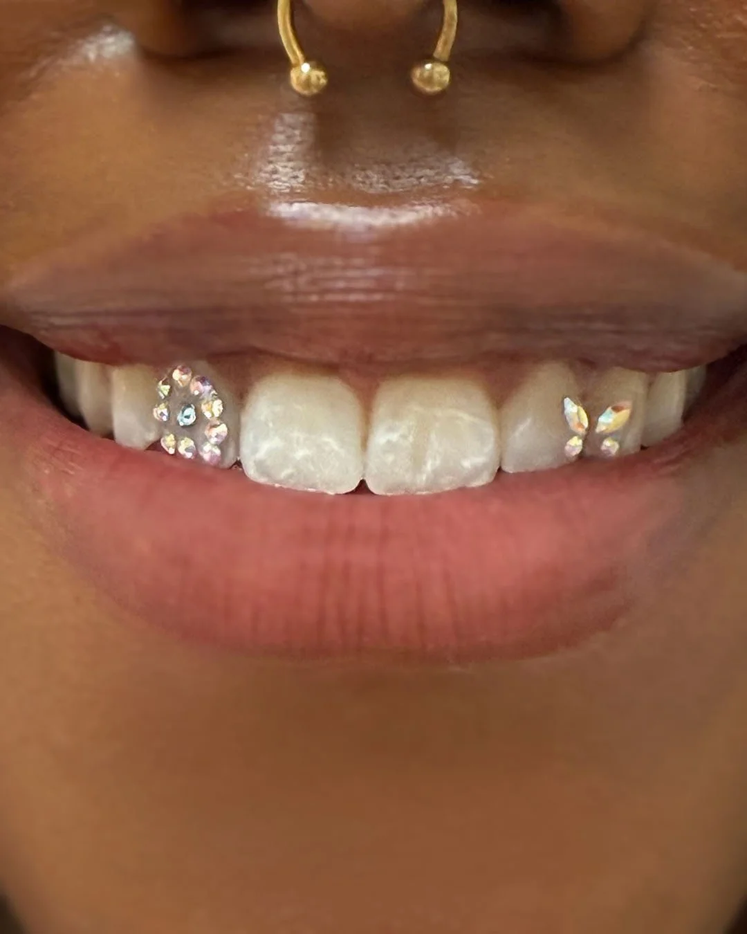 A woman smiling widely, her teeth adorned with sparkling diamonds, showcasing a unique and extravagant dental style.