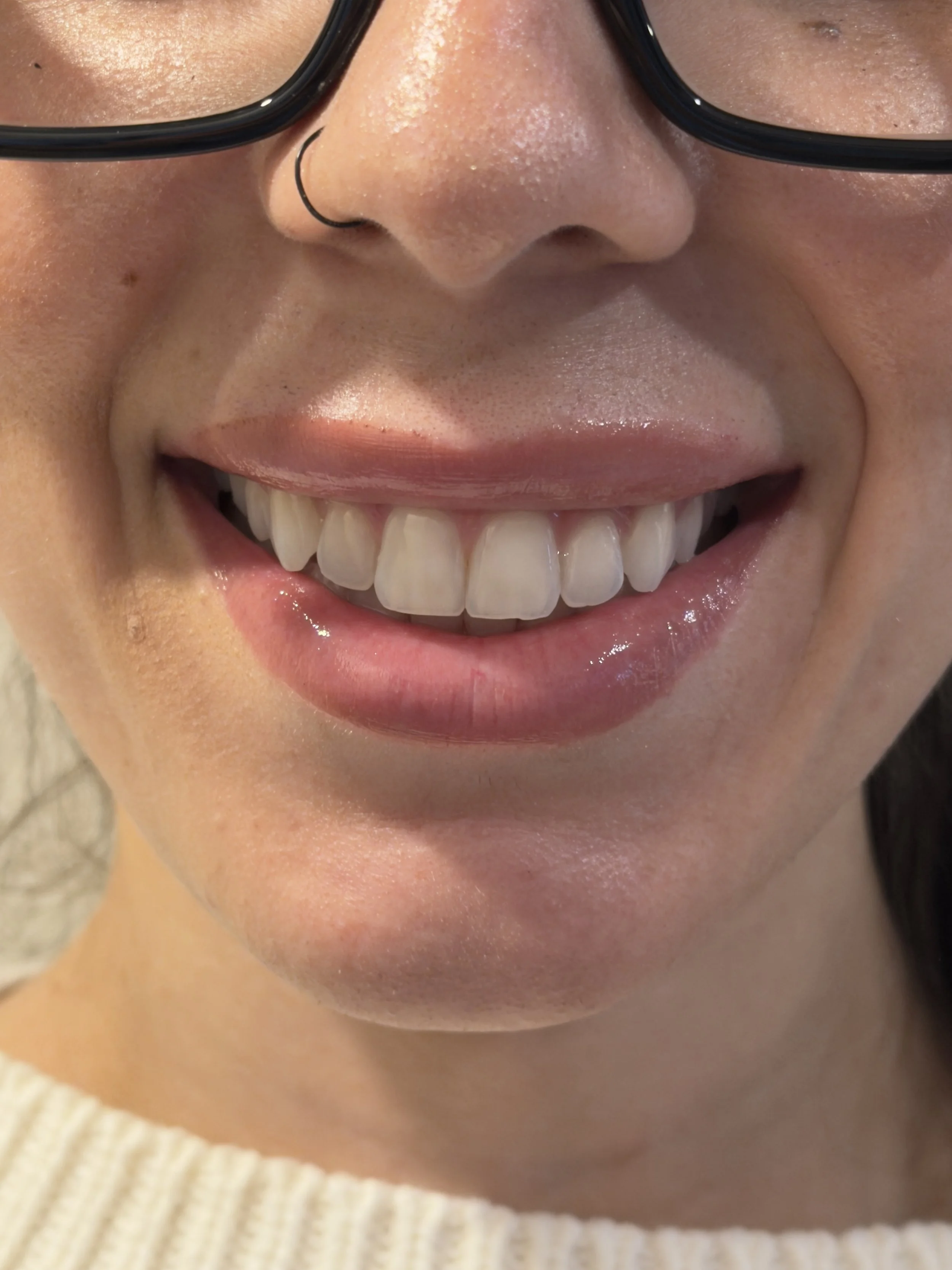 Online dental consult Riverside CA smile evaluation and treatment planning