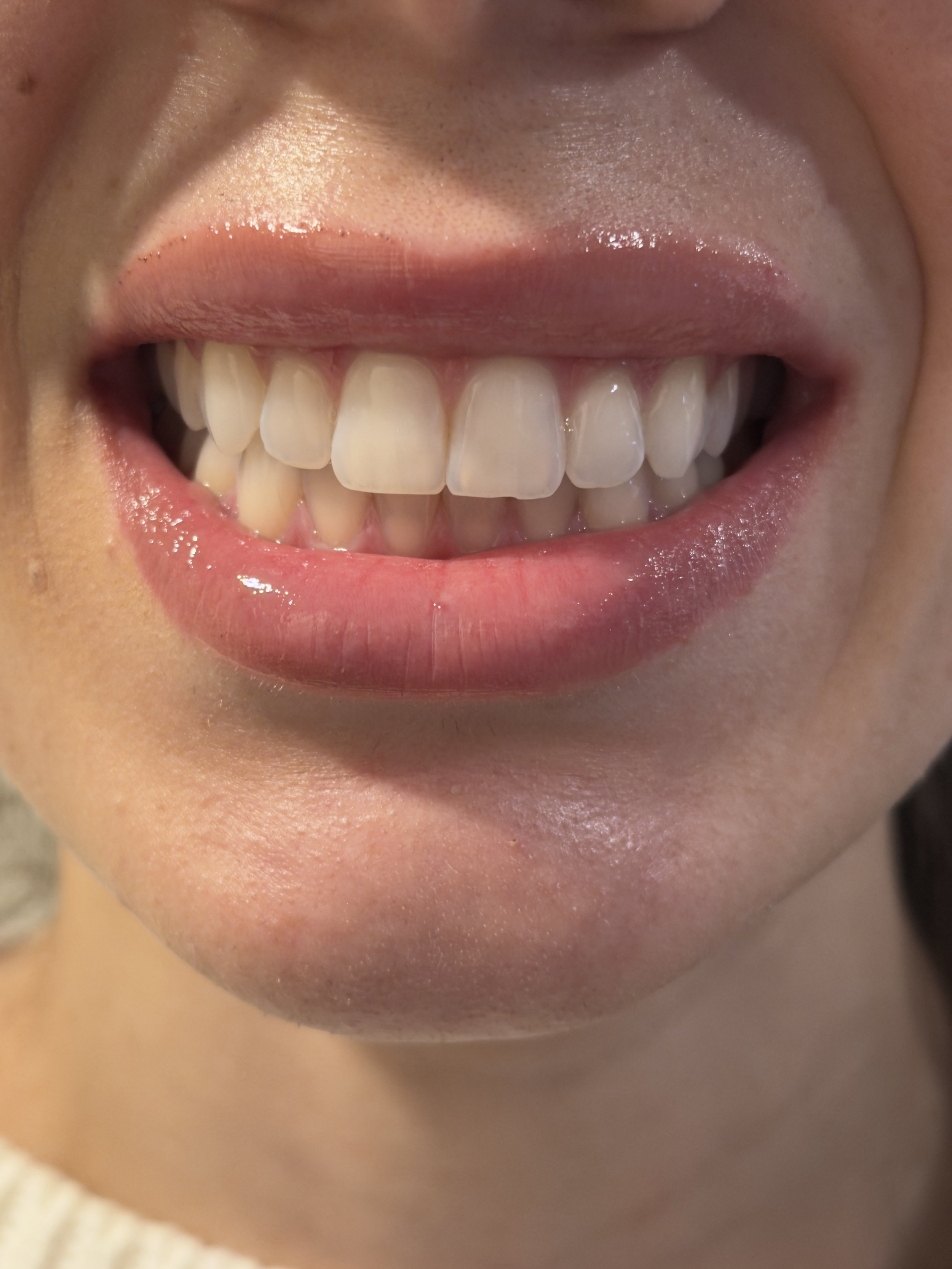 Virtual smile consultation Riverside CA cosmetic dentistry evaluation