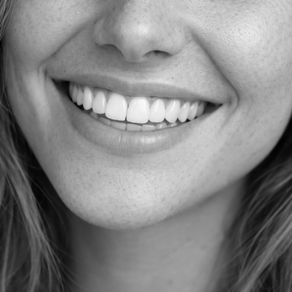 Beautiful smile cosmetic dentistry Riverside CA veneers and whitening