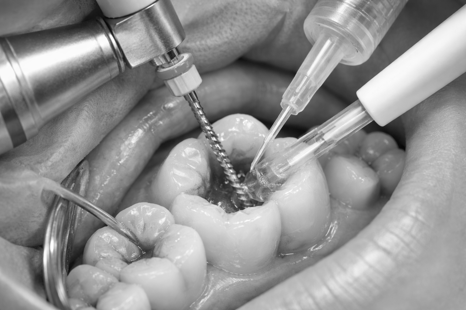 Root canal treatment Riverside CA pain relief endodontic therapy