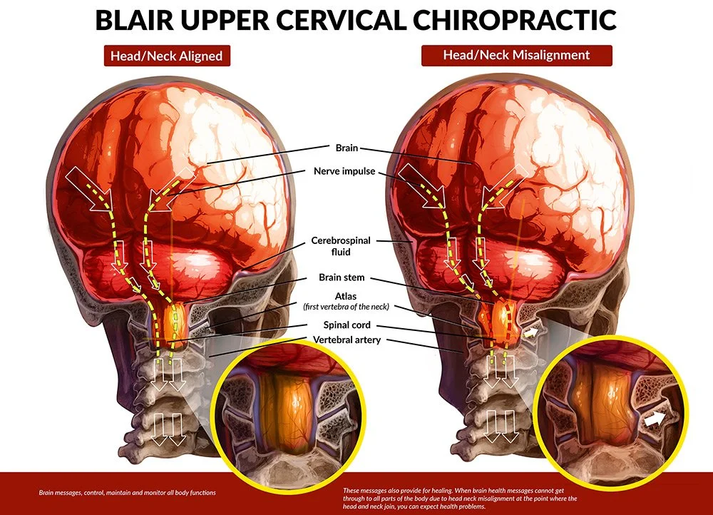 Blair Upper Cervical Chiropractic? Personalized Care in San Diego