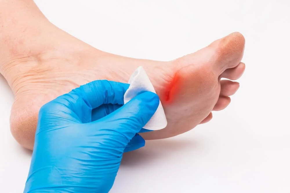 wound care specialist in  boynton beach, loxahatchee, florida podiatrist