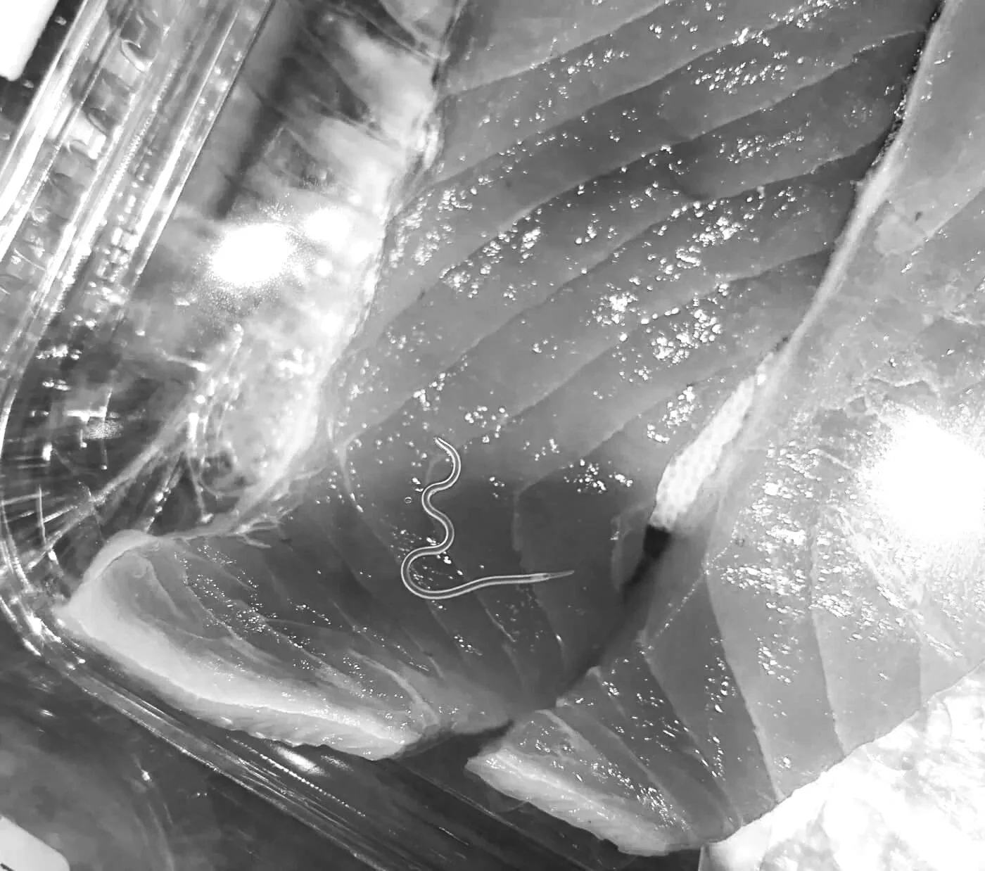 A close-up black-and-white photo of a plastic bag containing a long, slender worm or parasite.