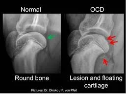 Osteochondritis Dissecans (OCD) in Dogs: Causes, Symptoms, and Treatment