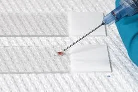 fine needle aspirate dr roger hart