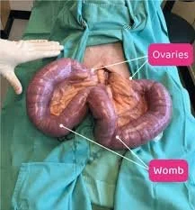 surgery Pyometra