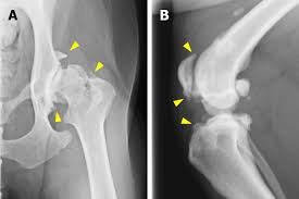 knee arthritis bushnell fl