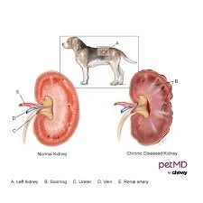 end stage kidney disease