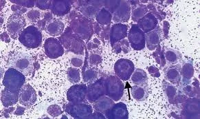 mast cells