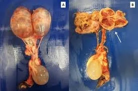 chronic kidney disease cat dr hart