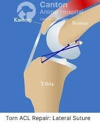 lateral capsular acl repair