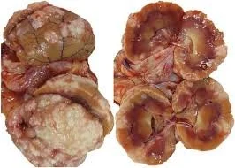 kidney cancer cat brooksville florida