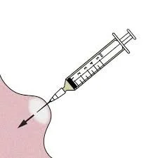 fine needle aspirate