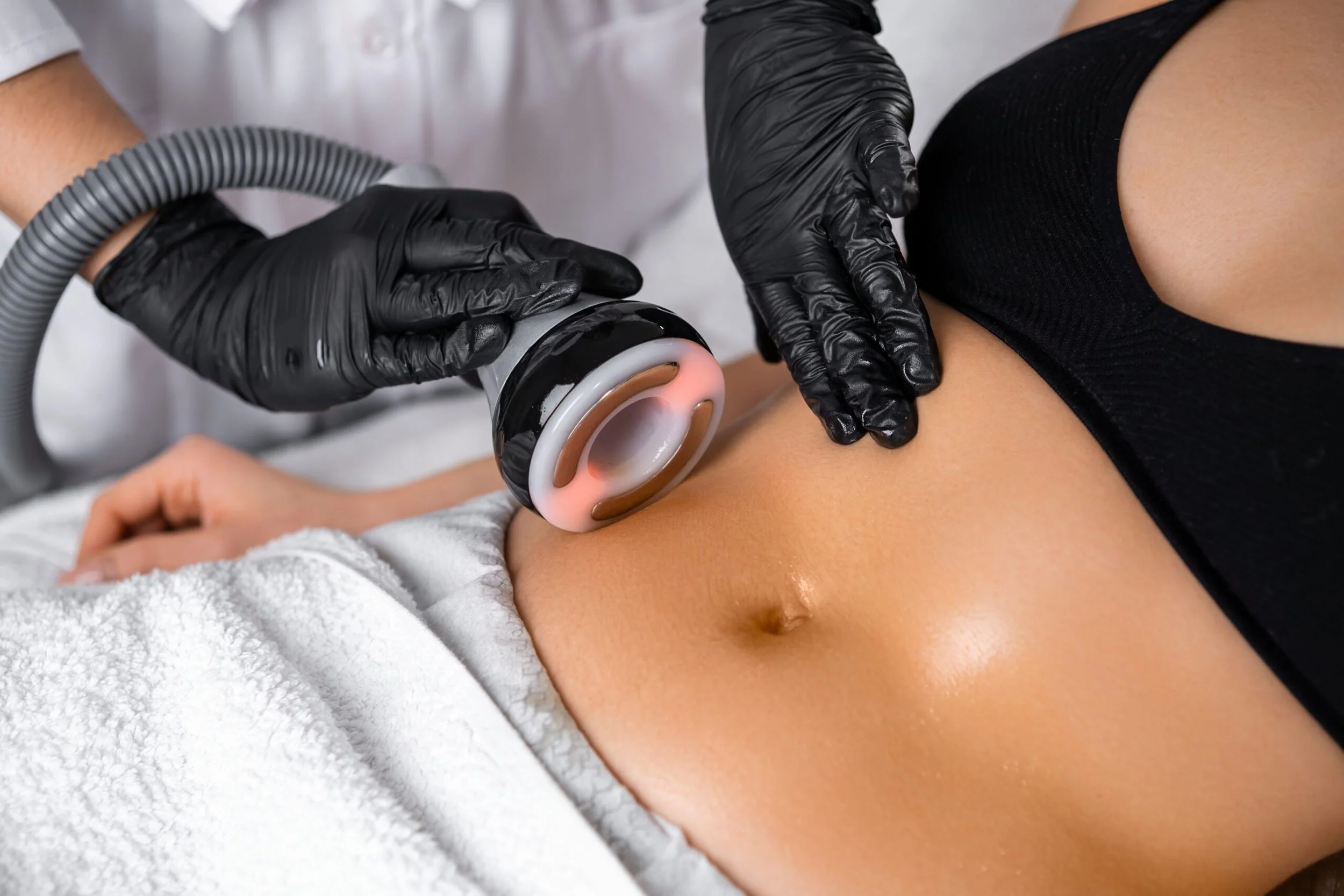A person receiving a laser hair removal treatment on their armpit from a professional wearing black gloves.