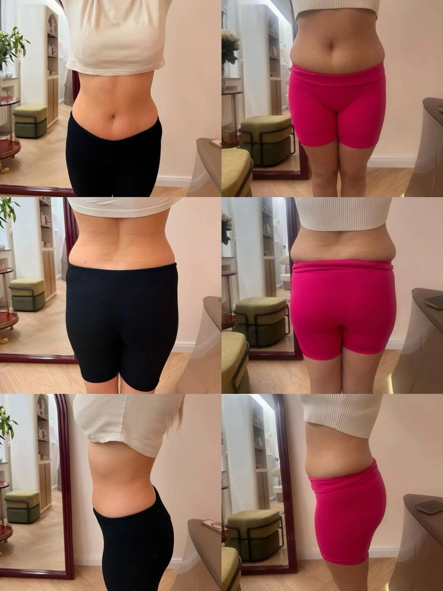 Hier seht ihr eine wundervolle Kundin, die sich als Testperson f&uuml;r unsere Sanduhr-Figur Transformation bereitgestellt hat. ✨

Das Ergebnis nach nur sechs Sessions spricht bereits f&uuml;r sich &ndash; und wir sind noch lange nicht am Ziel. Die T