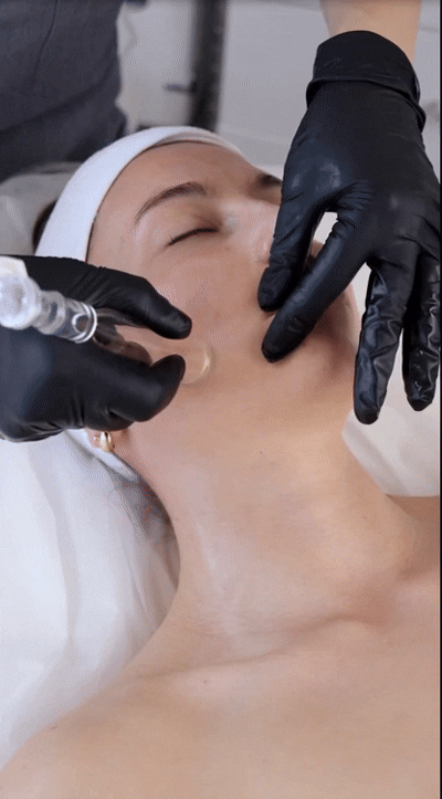 LYMPHATIC DRAINAGE