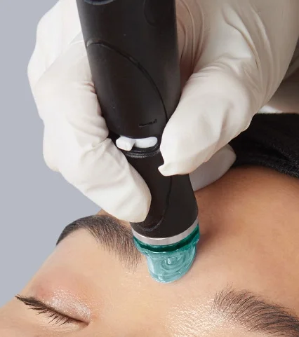Extractions by Hydrafacial at Beyond facials Santa Monica