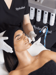 Receiving a facial treatment in a spa or clinic, with an aesthetician using a Hydrafacial machine device to her face at Beyond Facials Santa Monica
