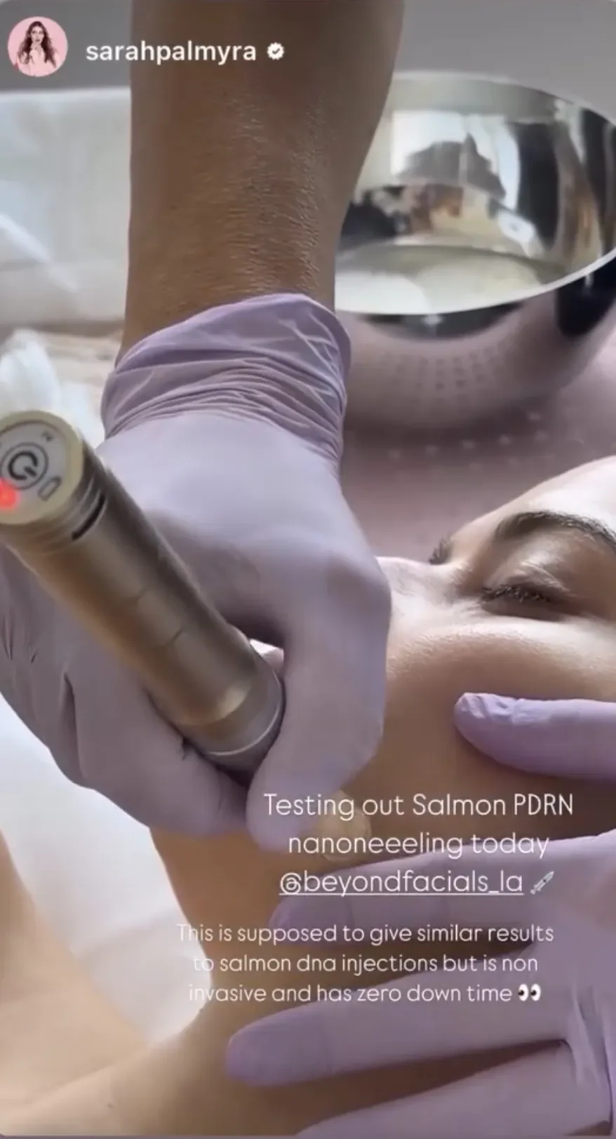 Nano Facial in action