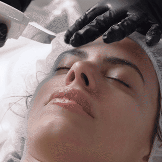 Ultrasound Scrubber for better extracions Beyond Facials Santa Monica