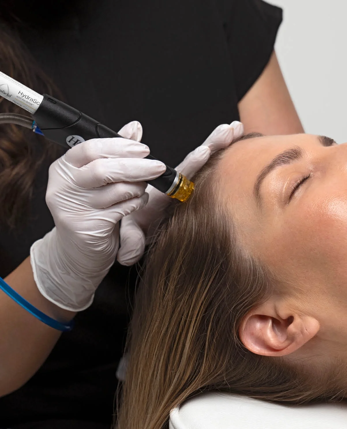 scalp treatment santa monica