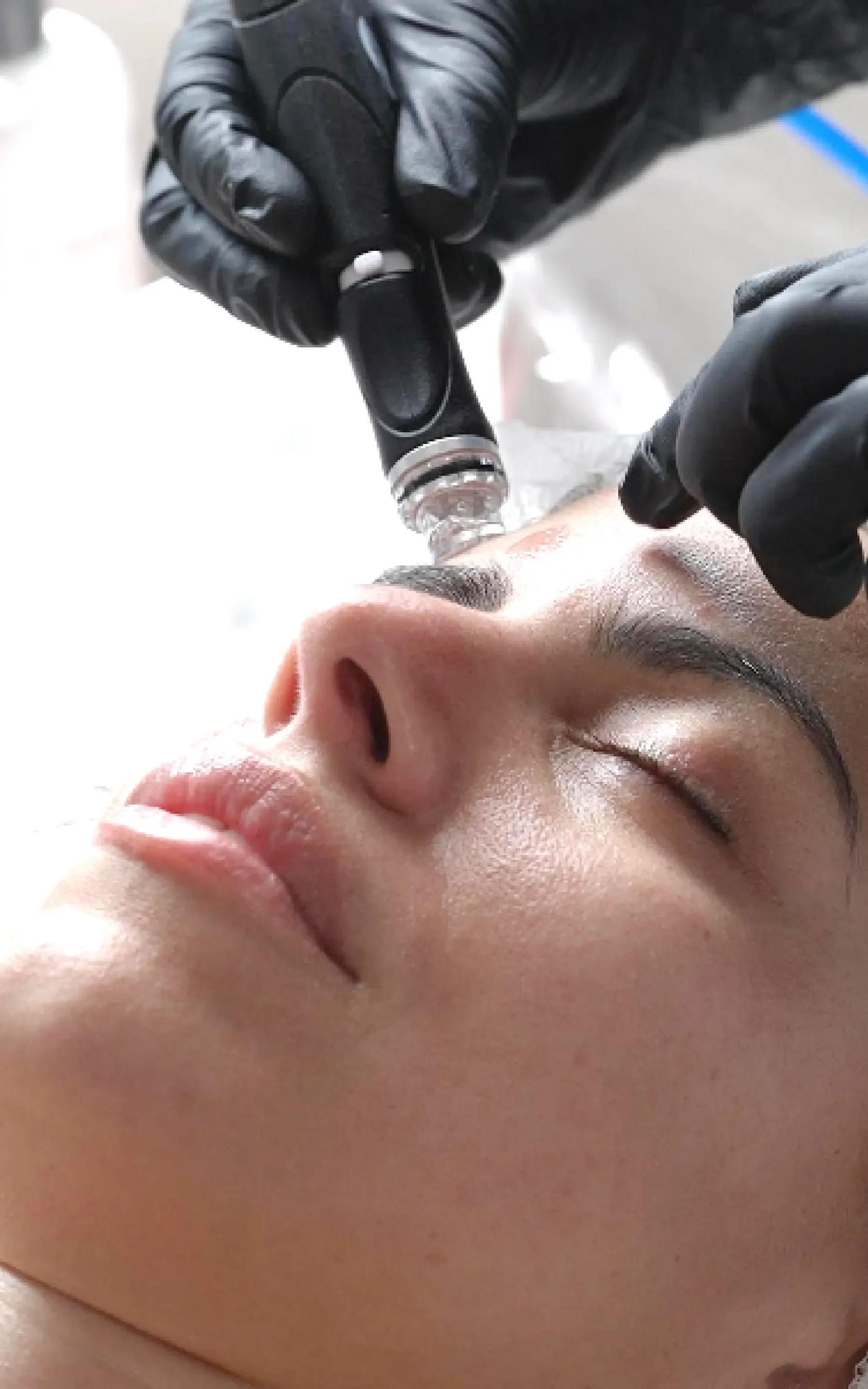 1hydrafacial.webp