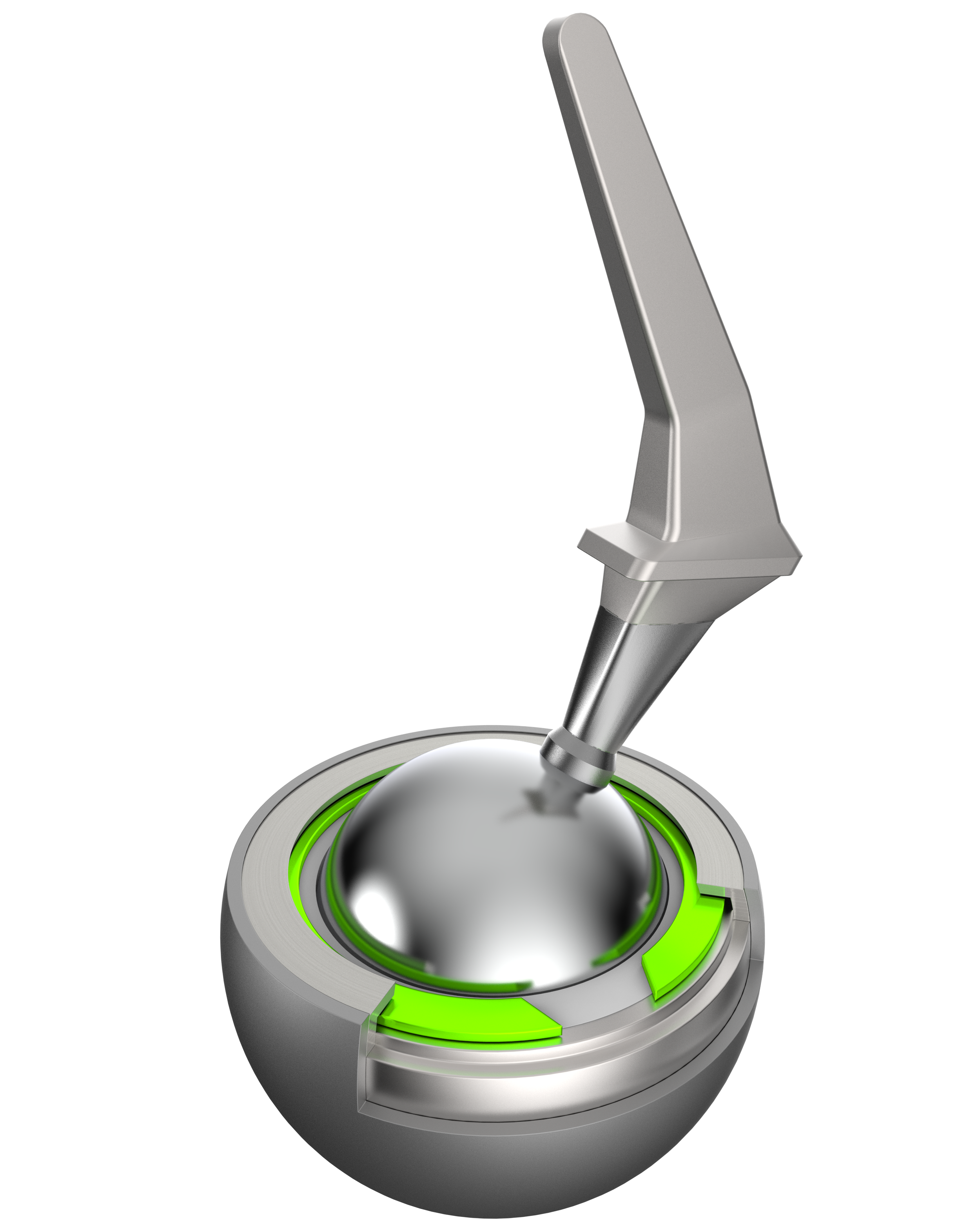 Hip Replacement with Retaining Ring