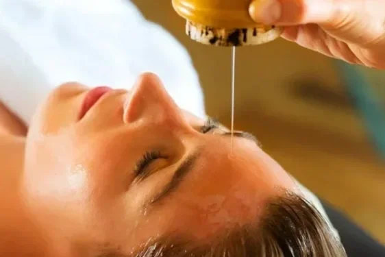 A woman receiving an acupuncture treatment on her forehead with thin needles inserted.