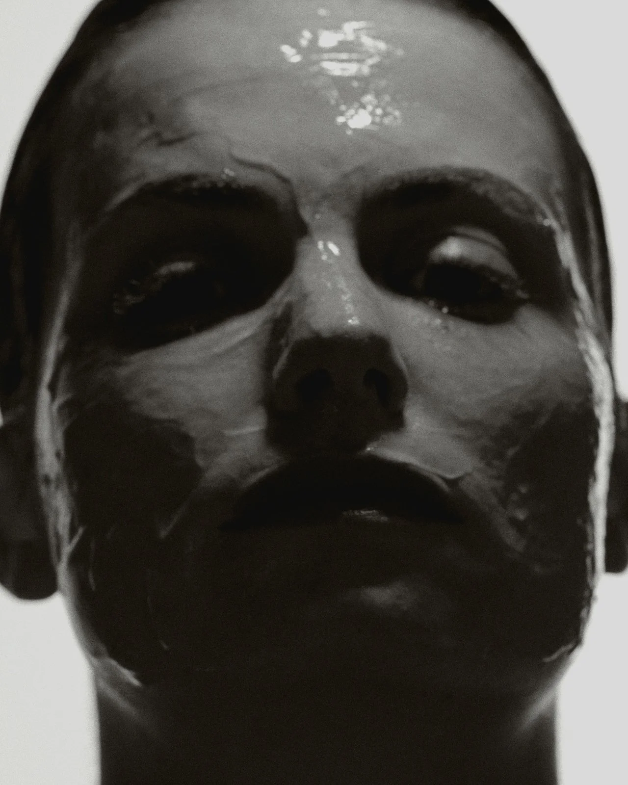 Collagen Thread Lift