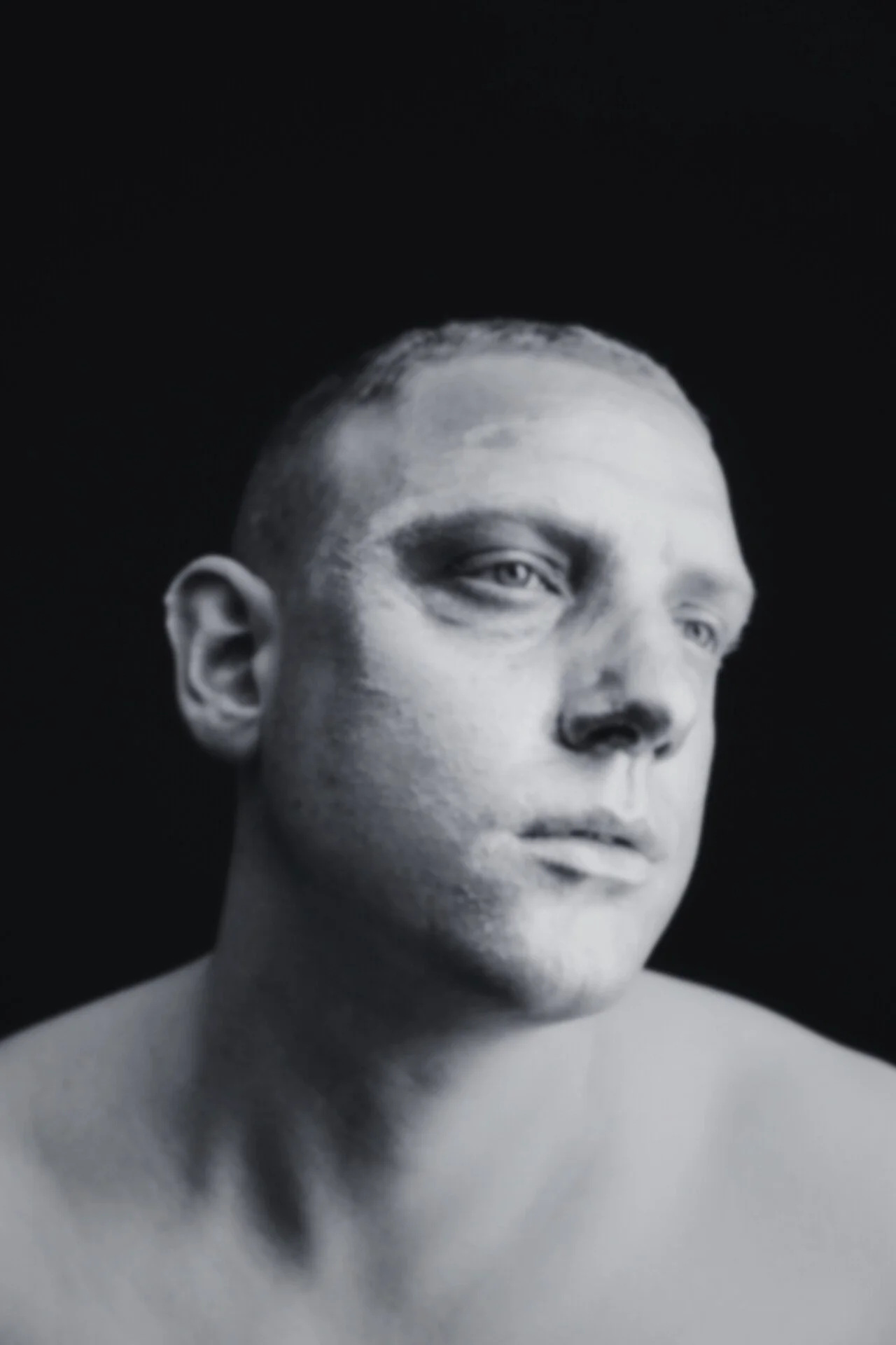 iS Clinical Prodigy Peel