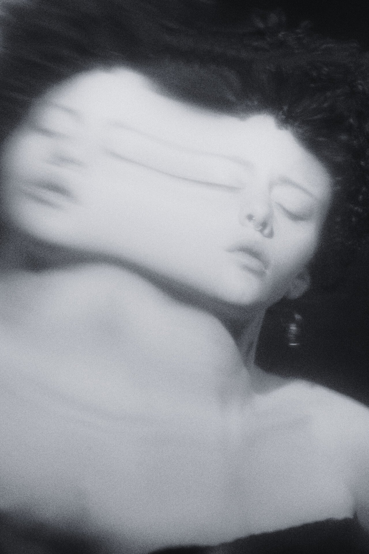 Nano Needling w/ PDRN