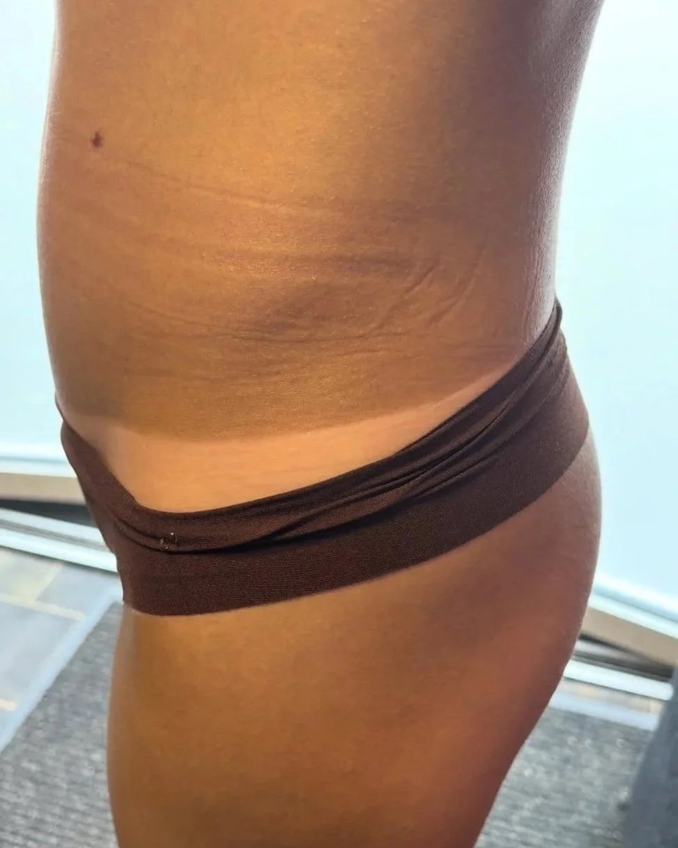 Close-up of a person's side torso and hip wearing dark brown underwear, with skin showing slight stretch marks and a small mole.