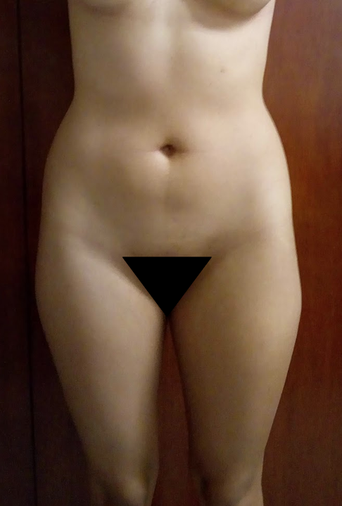Parte del cuerpo de una mujer desnuda, mostrando el abdomen y las caderas, con una marca negra en la zona genital.