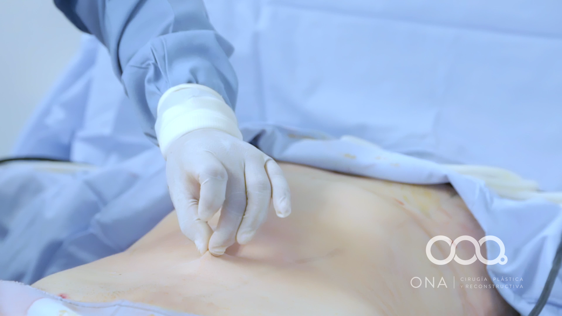 Procedimiento quirúrgico en un paciente, con un médico usando guantes y ropa de protección blanca.