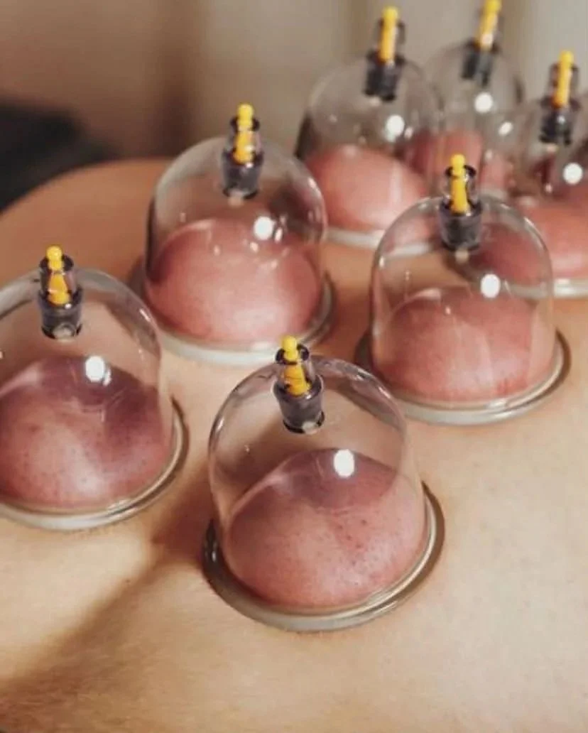 Close-up of multiple tattoo ink caps arranged on a person's back during a tattoo session.