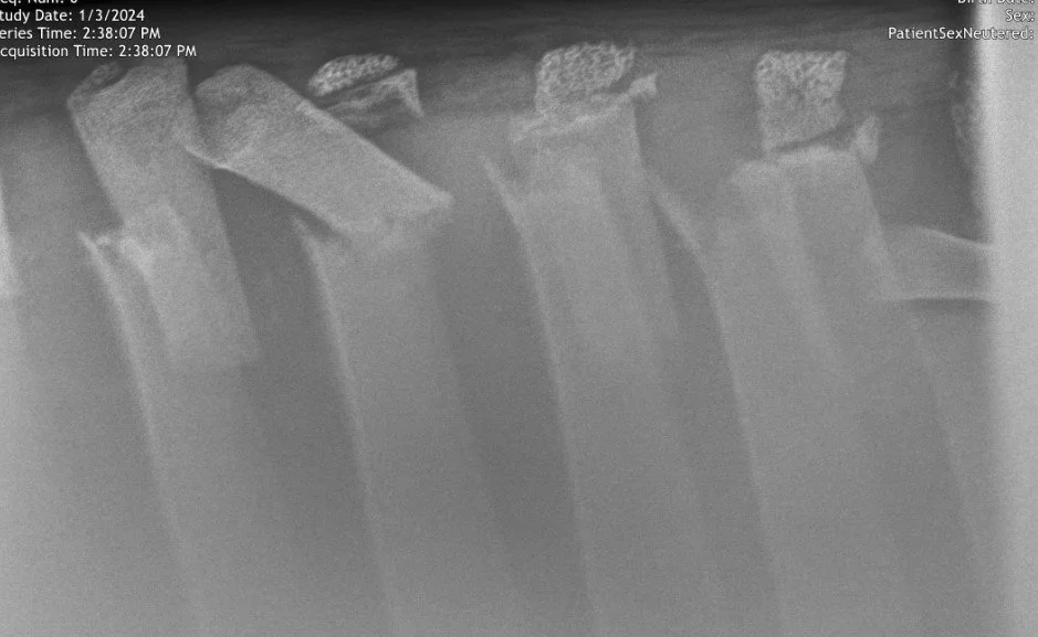 A Spine-Chilling Injury