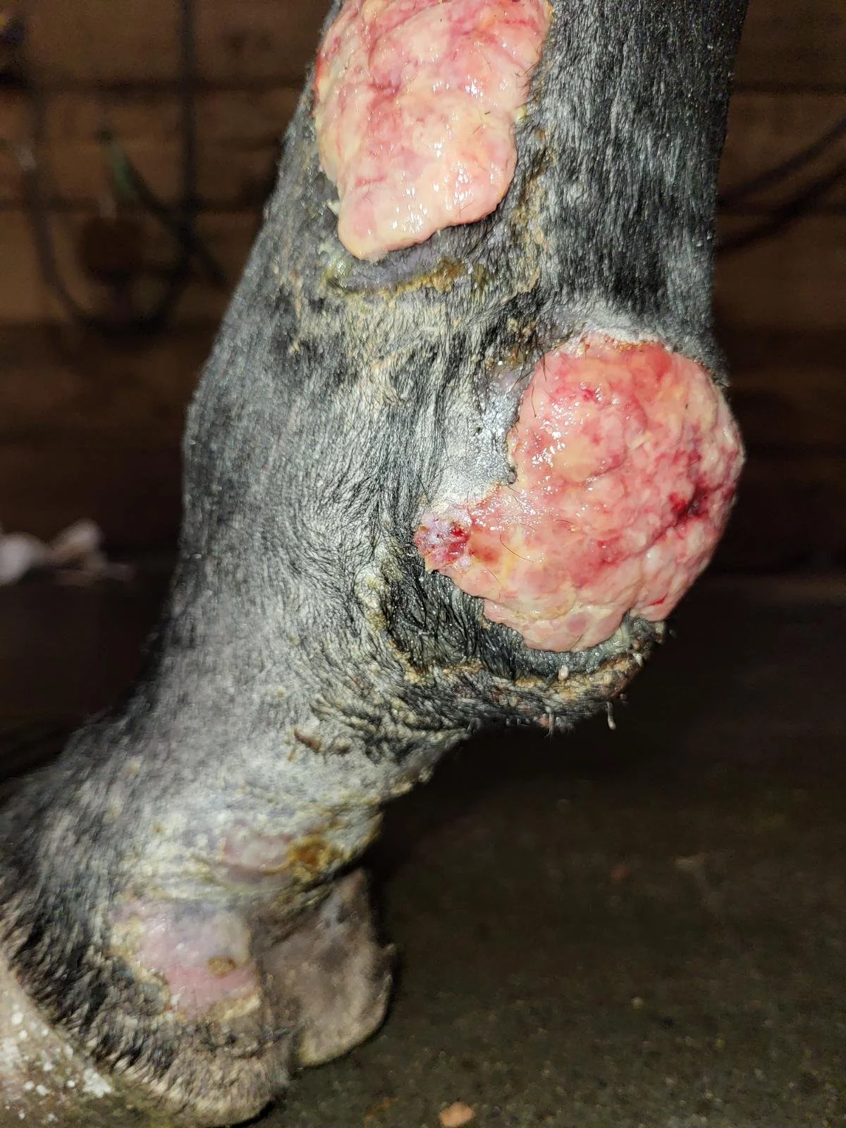 A Long Road of Cellulitis