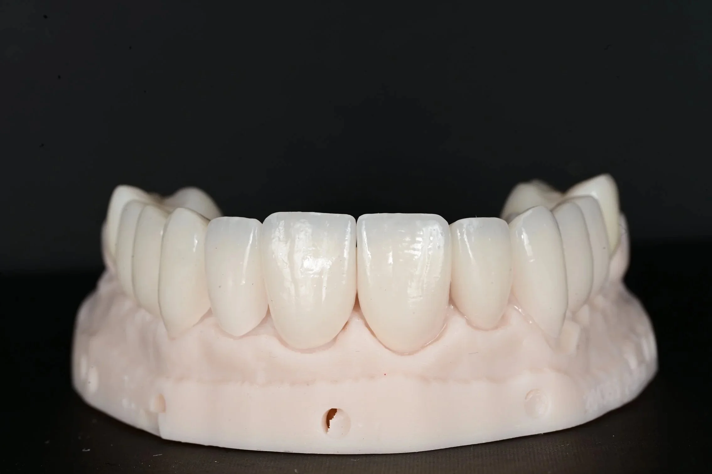 A dental model displaying a set of artificial teeth, with a focus on the front upper teeth against a dark background. porcelain veneers
