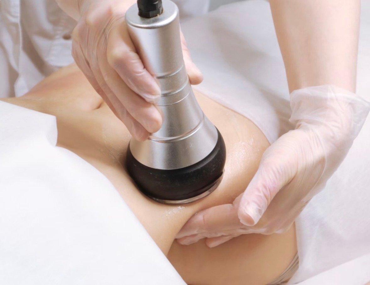 Non-Invasive Ultrasonic Cavitation Body Contouring