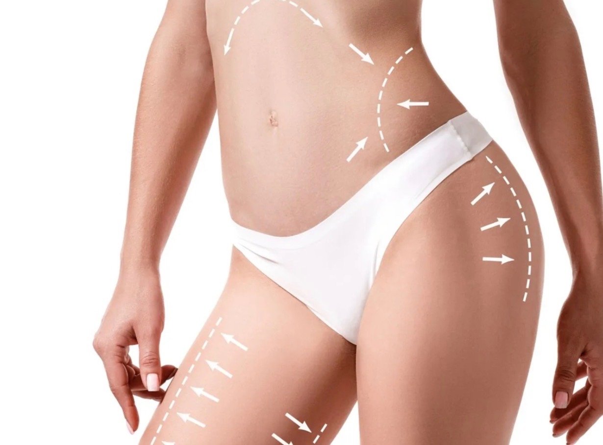 Body Sculpting Package