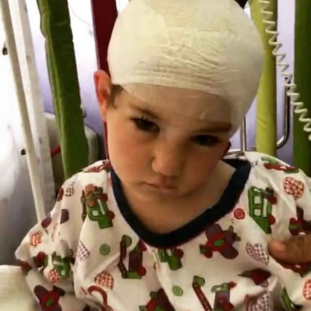 A young boy with a bandaged head resting in a hospital bed, wearing a pajama top with Christmas-themed patterns.