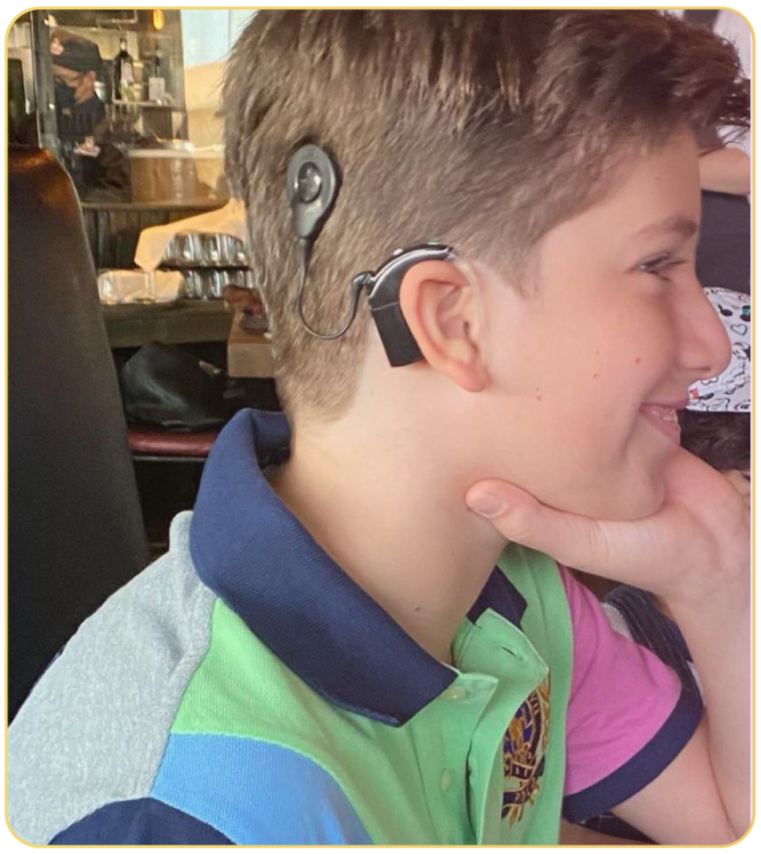 A young boy sitting at a restaurant table, wearing a hearing aid and cochlear implant. He has short brown hair and is smiling, resting his face on his hand.