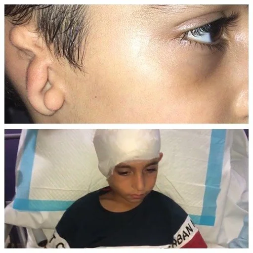 Top: Close-up of a boy’s face focusing on his eye and ear. Bottom: A boy wearing a medical head cap, lying in a hospital bed with a neutral expression.
